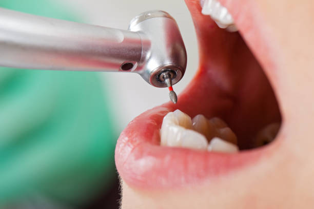 Best Cosmetic Emergency Dentistry in South Boston, VA